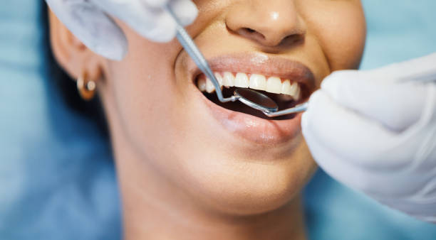 Best Knocked-Out Tooth (Avulsed Tooth) Treatment in Winterville, NC