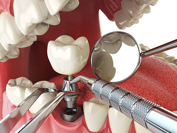 Best Broken or Chipped Tooth Repair in Winterville, NC
